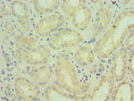CYP4A11 Antibody - Immunohistochemistry of paraffin-embedded human kidney tissue using CYP4A11 Antibody at dilution of 1:100