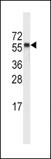 CYP4A11 Antibody - Western blot of anti-CYP4A11 (4A22) Antibody in NCI-H460 cell line lysates (35 ug/lane). CYP4A11(arrow) was detected using the purified antibody.