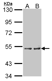 CYP4A11 Antibody - Sample (30 ug of whole cell lysate). A: A431, B: H1299. 7.5% SDS PAGE. CYP4A11 antibody diluted at 1:100