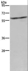 CYP4A11 Antibody - Western blot analysis of Mouse liver tissue, using CYP4A11 Polyclonal Antibody at dilution of 1:250.