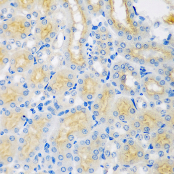 CYP4A11 Antibody - Immunohistochemistry of paraffin-embedded mouse kidney tissue.