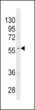 CYP4B1 Antibody - Western blot of CYP4B1 Antibody in MDA-MB468 cell line lysates (35 ug/lane). CYP4B1 (arrow) was detected using the purified antibody.