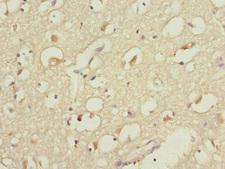 CYP4B1 Antibody - Immunohistochemistry of paraffin-embedded human brain tissue at dilution 1:100