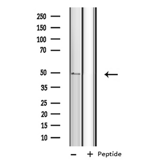 CYP4B1 Antibody - Western blot analysis of extracts of COLO cells using Cytochrome P450 4B1 antibody.
