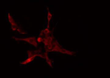 CYP4B1 Antibody - Staining COLO205 cells by IF/ICC. The samples were fixed with PFA and permeabilized in 0.1% Triton X-100, then blocked in 10% serum for 45 min at 25°C. The primary antibody was diluted at 1:200 and incubated with the sample for 1 hour at 37°C. An Alexa Fluor 594 conjugated goat anti-rabbit IgG (H+L) antibody, diluted at 1/600, was used as secondary antibody.