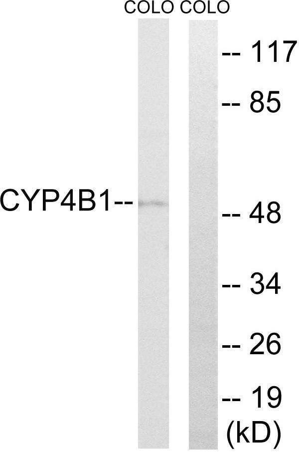 CYP4B1 Antibody - Western blot analysis of extracts from COLO cells, using Cytochrome P450 4B1 antibody.