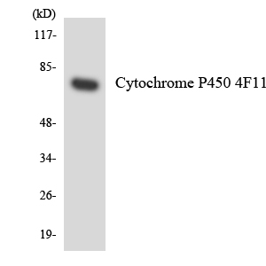 CYP4F11 Antibody - Western blot analysis of the lysates from COLO205 cells using Cytochrome P450 4F11 antibody.