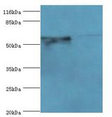 CYP4F11 Antibody - Western blot. All lanes: CYP4F11 antibody at 2 ug/ml Lane 1:mouse liver tissue. Lane 2: mouse kidney tissue. Secondary antibody: Goat polyclonal to rabbit at 1:10000 dilution. Predicted band size: 60 kDa. Observed band size: 60 kDa.  This image was taken for the unconjugated form of this product. Other forms have not been tested.