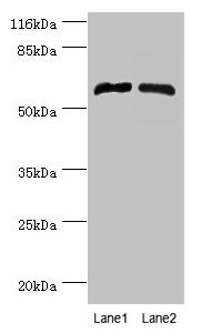 CYP4F11 Antibody - Western blot All lanes: CYP4F11 antibody at 2µg/ml Lane 1: Mouse liver tissue Lane 2: Mouse kidney tissue Secondary Goat polyclonal to rabbit IgG at 1/10000 dilution Predicted band size: 60 kDa Observed band size: 60 kDa