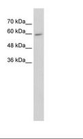 CYP4F11 Antibody - HepG2 Cell Lysate.  This image was taken for the unconjugated form of this product. Other forms have not been tested.