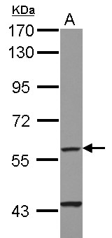 CYP4F11 Antibody - Sample (30 ug of whole cell lysate) A: HepG2 7.5% SDS PAGE CYP4F11 / CYPIVF11 antibody diluted at 1:1000