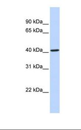 CYP4F12 Antibody - Placenta lysate. Antibody concentration: 1.0 ug/ml. Gel concentration: 12%.  This image was taken for the unconjugated form of this product. Other forms have not been tested.