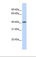 CYP4F12 Antibody - Placenta lysate. Antibody concentration: 1.0 ug/ml. Gel concentration: 12%.  This image was taken for the unconjugated form of this product. Other forms have not been tested.