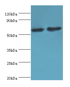 CYP4F12 Antibody - Western blot. All lanes: CYP4F12 antibody at 6 ug/ml. Lane 1: mouse small intestine tissue. Lane 2: rat liver tissue. Secondary antibody: Goat polyclonal to rabbit at 1:10000 dilution. Predicted band size: 60 kDa. Observed band size: 60 kDa.