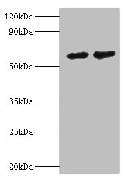 CYP4F12 Antibody - Western blot All lanes: CYP4F12 antibody at 6µg/ml Lane 1: Mouse small intestine tissue Lane 2: Rat liver tissue Secondary Goat polyclonal to rabbit IgG at 1/10000 dilution Predicted band size: 61, 12 kDa Observed band size: 61 kDa