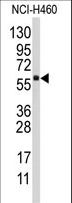 CYP4F12 Antibody - Western blot of anti-CYP4F12 Antibody in NCI-H460 cell line lysates (35 ug/lane). CYP4F12(arrow) was detected using the purified antibody.
