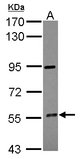 CYP4F12 Antibody - Sample (30 ug of whole cell lysate) A: HepG2 7.5% SDS PAGE CYP4F12 antibody diluted at 1:500