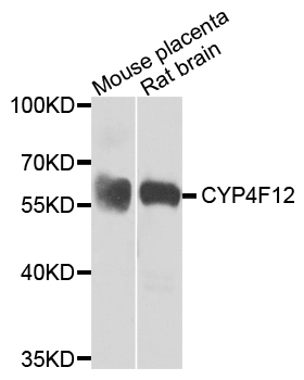 CYP4F12 Antibody - Western blot analysis of extracts of mouse placenta and rat brain.