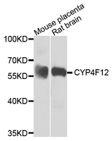 CYP4F12 Antibody - Western blot analysis of extracts of mouse placenta and rat brain.
