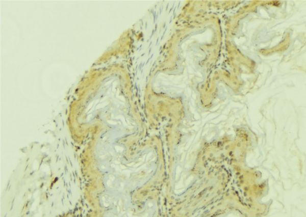 CYP4F12 Antibody - 1:100 staining mouse colon tissue by IHC-P. The sample was formaldehyde fixed and a heat mediated antigen retrieval step in citrate buffer was performed. The sample was then blocked and incubated with the antibody for 1.5 hours at 22°C. An HRP conjugated goat anti-rabbit antibody was used as the secondary.