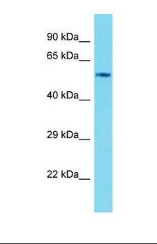 Cyp4f17 Antibody - Western blot of Mouse Kidney. Cyp4f17 antibody dilution 1.0 ug/ml.  This image was taken for the unconjugated form of this product. Other forms have not been tested.