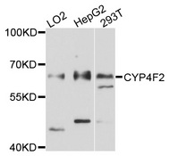 CYP4F2 Antibody - Western blot analysis of extracts of various cell lines, using CYP4F2 antibody at 1:1000 dilution. The secondary antibody used was an HRP Goat Anti-Rabbit IgG (H+L) at 1:10000 dilution. Lysates were loaded 25ug per lane and 3% nonfat dry milk in TBST was used for blocking. An ECL Kit was used for detection and the exposure time was 5s.