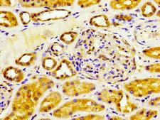 CYP4F2 Antibody - Immunohistochemistry image at a dilution of 1:200 and staining in paraffin-embedded human kidney tissue performed on a Leica BondTM system. After dewaxing and hydration, antigen retrieval was mediated by high pressure in a citrate buffer (pH 6.0) . Section was blocked with 10% normal goat serum 30min at RT. Then primary antibody (1% BSA) was incubated at 4 °C overnight. The primary is detected by a biotinylated secondary antibody and visualized using an HRP conjugated SP system.