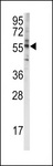 CYP4F8 Antibody - Western blot of anti-CYP4F8 Antibody in K562 cell line lysates (35 ug/lane). CYP4F8(arrow) was detected using the purified antibody.