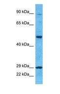 CYP4F8 Antibody - Western blot of CP4F8 Antibody with human 786-0 Whole Cell lysate.  This image was taken for the unconjugated form of this product. Other forms have not been tested.