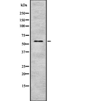 CYP4F8 Antibody - Western blot analysis of Cytochrome P450 4F8 using Jurkat whole cells lysates
