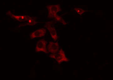 CYP4V2 Antibody - Staining HeLa cells by IF/ICC. The samples were fixed with PFA and permeabilized in 0.1% Triton X-100, then blocked in 10% serum for 45 min at 25°C. The primary antibody was diluted at 1:200 and incubated with the sample for 1 hour at 37°C. An Alexa Fluor 594 conjugated goat anti-rabbit IgG (H+L) antibody, diluted at 1/600, was used as secondary antibody.