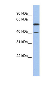 CYP4V2 Antibody - CYP4V2 antibody Western blot of Jurkat lysate. This image was taken for the unconjugated form of this product. Other forms have not been tested.