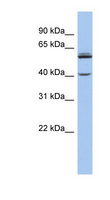 CYP4V2 Antibody - CYP4V2 antibody Western blot of Jurkat lysate. This image was taken for the unconjugated form of this product. Other forms have not been tested.