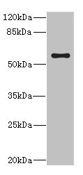 CYP4V2 Antibody - Western blot All Lanes:CYP4V2 antibody at 0.85ug/ml+Jurkat whole cell lysate Secondary Goat polyclonal to rabbit at 1/10000 dilution Predicted band size: 61,59 kDa Observed band size: 61 kDa