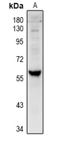 CYP4V2 Antibody - Western blot analysis of Cytochrome P450 4V2 expression in U87MG (A) whole cell lysates.
