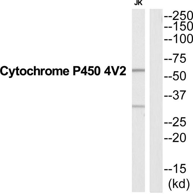 CYP4V2 Antibody - Western blot analysis of extracts from Jurkat cells, using CYP4V2 antibody.