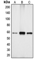 CYP4X1 Antibody - Western blot analysis of Cytochrome P450 4X1 expression in Jurkat (A); mouse kidney (B); rat kidney (C) whole cell lysates.