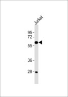 CYP4X1 Antibody - Anti-Cytochrome P450 4X1 Antibody at 1:1000 dilution + Jurkat whole cell lysates Lysates/proteins at 20 ug per lane. Secondary Goat Anti-Rabbit IgG, (H+L),Peroxidase conjugated at 1/10000 dilution Predicted band size : 59,58,51 kDa Blocking/Dilution buffer: 5% NFDM/TBST.
