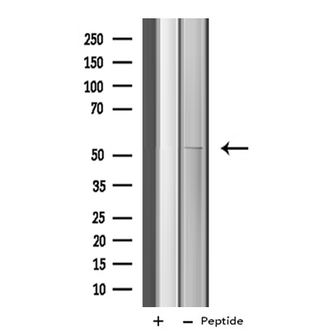 CYP4X1 Antibody - Western blot analysis of extracts of COS-7 cells using Cytochrome P450 4X1 antibody.