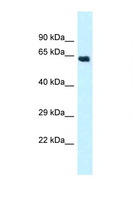 CYP4Z1 Antibody - CYP4Z1 antibody Western blot of Fetal Heart lysate. Antibody concentration 1 ug/ml.  This image was taken for the unconjugated form of this product. Other forms have not been tested.