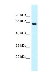 CYP4Z1 Antibody - CYP4Z1 antibody Western blot of Fetal Heart lysate. Antibody concentration 1 ug/ml.  This image was taken for the unconjugated form of this product. Other forms have not been tested.