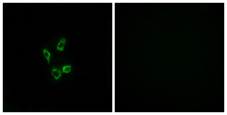 CYP4Z1 Antibody - Immunofluorescence analysis of HUVEC cells, using Cytochrome P450 4Z1 Antibody. The picture on the right is blocked with the synthesized peptide.