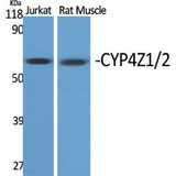 CYP4Z1 Antibody - Western blot of CYP4Z1/2 antibody
