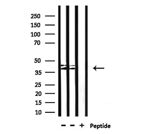 CYP4Z1 Antibody - Western blot analysis of extracts of mouse liver, mouse lung using Cytochrome P450 4Z1/2 antibody.