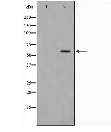 CYP4Z1 Antibody - Western blot analysis of extracts of rat brain cells using Cytochrome P450 4Z1 antibody. The lane on the left is treated with the antigen-specific peptide.