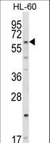CYP51A1 / CYP51 Antibody - Western blot of CYP51A1 Antibody in HL-60 cell line lysates (35 ug/lane). CYP51A1 (arrow) was detected using the purified antibody.