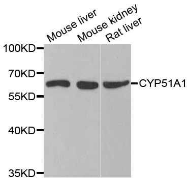 CYP51A1 / CYP51 Antibody - Western blot analysis of extracts of various cell lines.