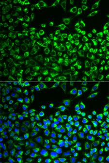 CYP51A1 / CYP51 Antibody - Immunofluorescence analysis of MCF-7 cells.