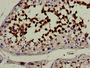 CYP51A1 / CYP51 Antibody - Immunohistochemistry of paraffin-embedded human testis tissue at dilution of 1:100