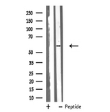 CYP51A1 / CYP51 Antibody - Western blot analysis of Cytochrome P450 51A1 using A431 whole cells lysates